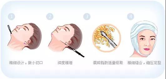 十大足球赌注软件